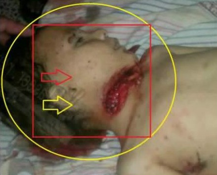 http://politicalfilm.files.wordpress.com/2013/09/banjas-kids-killed-by-al-nusra-al-qaeda-fsa.jpg